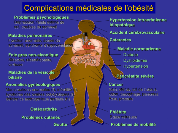 OBESITE